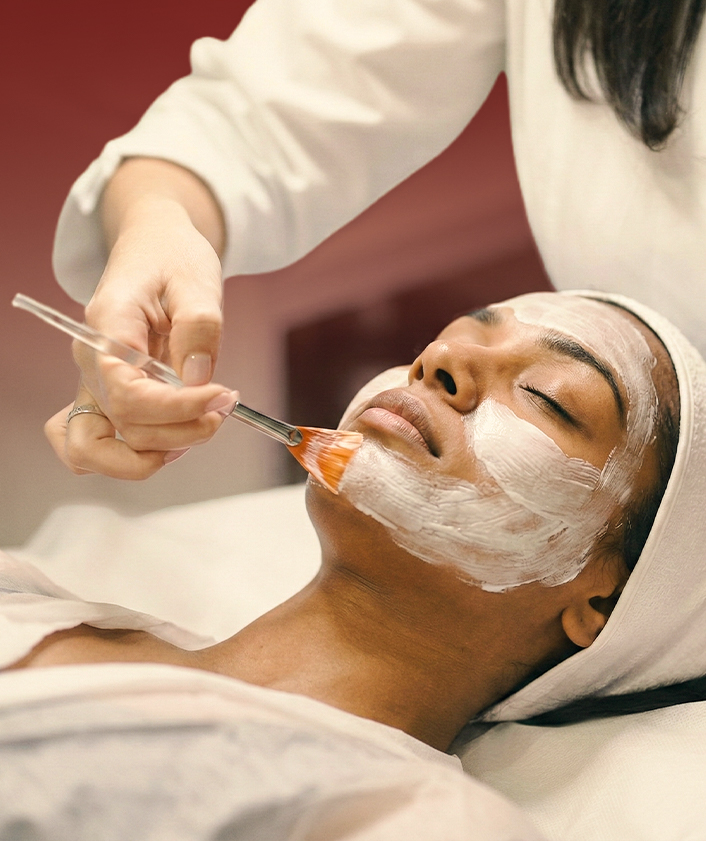 chemical peel